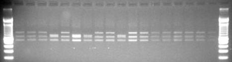 Prodotti PCR di ActA ristretti con DraI M