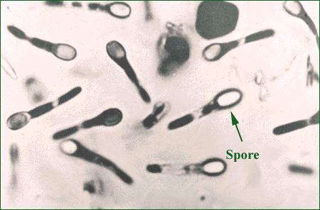 virulenza Clostridium botulinum