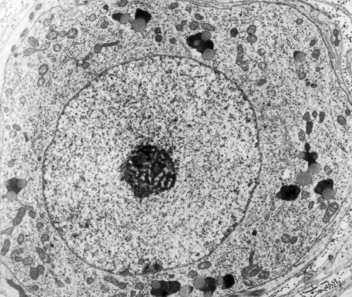 Nuclei ricchi di eterocromatina localizzata essenzialmente alla