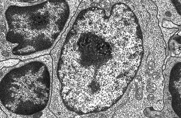 Questa morfologia è tipica di cellule poco attive da un punto di vista