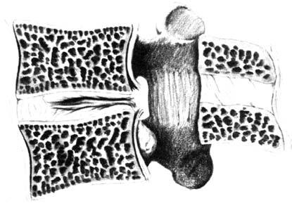 canale vertebrale