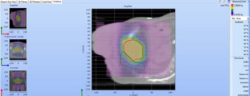 Prostata DVH su Anatomy Prostata-PTV DE% (tps vs Delta4 PB) = 3.