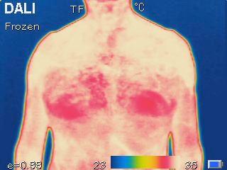 alternato con Tecarterapia Therma