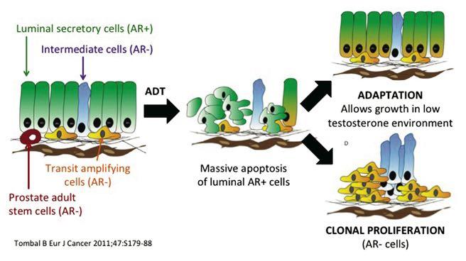 Optimizing survival in advanced prostate cancer 3 Figura 5. Mutazioni rilevate nel cancro della prostata primitivo ad alto rischio.