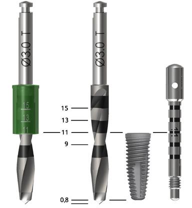 Protocollo di fresatura e guida per la profondità di preparazione - Impianto Neoss Tapered Tapered Ø3.5 mm Tapered Ø4.0 mm Tapered Ø4.5 mm Tapered Ø5.0 mm Tapered Ø5.5 mm Stop di profondità Ø6.