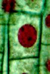 Prophase Metaphase