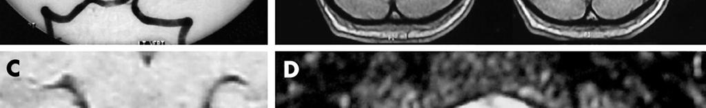 cranial nerve