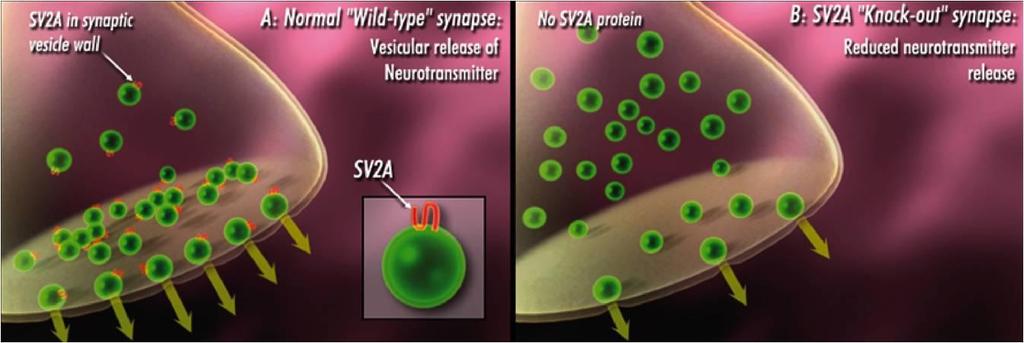 miglioramento in pazienti con epilessia parziale farmaco-resistente. I principali effetti collaterali legati alla terapia con retigabina sono vertigini, sonnolenza e stanchezza.