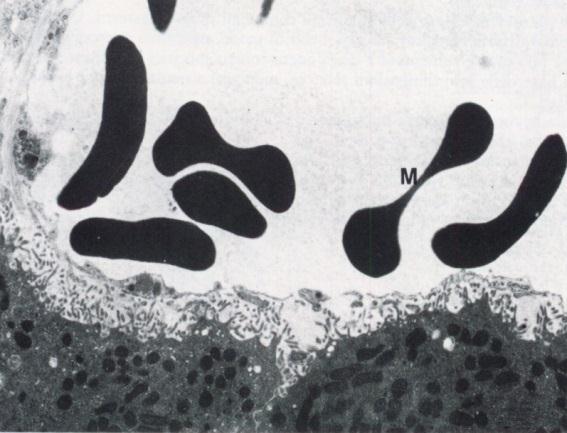 5x10 13 GR in un adulto cellule di forma a lente biconcava (Ø di 7-8 um; spessore 1 um) misuratori istologici l eritrocita maturo