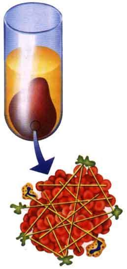 Quando è prelevato dai vasi il sangue coagula rapidamente in una massa rossastra gelatinosa (coagulo) siero Se la coagulazione è impedita con l