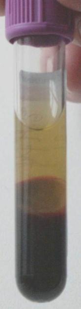 Prima della centrifugazione Dopo centrifugazione COMPOSIZIONE plasma ( 55 %) soluzione proteica di colore giallognolo