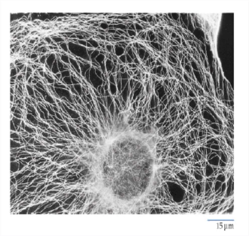 La disposizione dei microtubuli nella cellula (animale o vegetale) può essere evidenziata mediante l