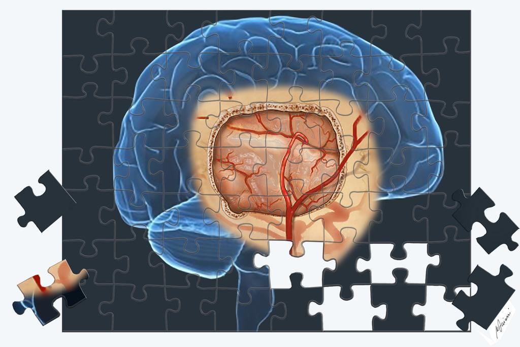 Third Annual Bellaria Neurovascular Conference By-pass and beyond.