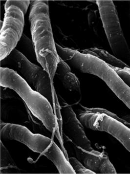 Allontanandosi dalla fovea, aumenta il numero di bastoncelli.