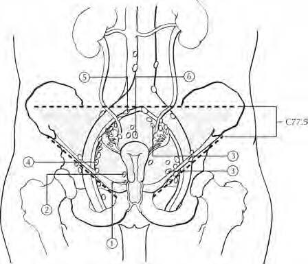 FIGURA 28.1. Sedi e sottosedi anatomiche della cervice uterina.
