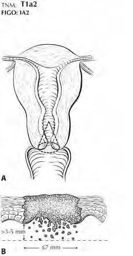 FIGURA 28.4.