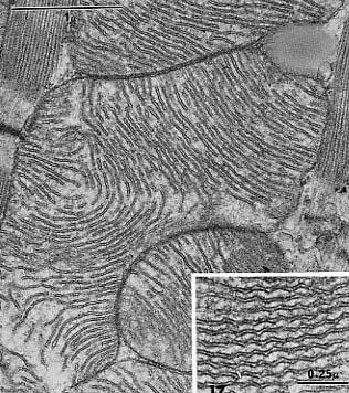 Mitocondri con diversa morfologia