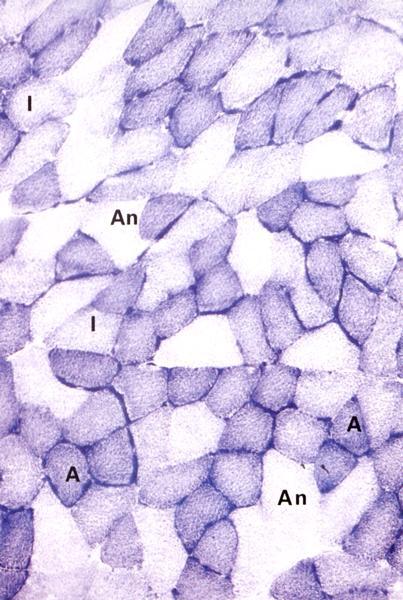 Cellule con pochi mitocondri Fibre muscolari scheletriche tipo II Fibre