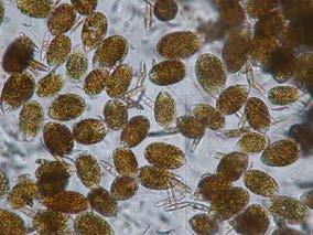 Il monitoraggio della microalga potenzialmente tossica Ostreopsis ovata lungo le coste italiane Patrizia