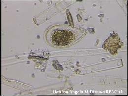 OSTREOPSIS Microrganismo unicellulare avente la forma di una goccia d acqua Classe delle Dinophyceae, ordine Peridiniales,