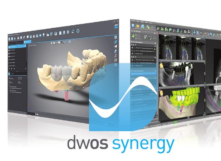 DWOS SYNERGY - RIDURRE IL TEMPO DI PRODUZIONE AUMENTARE LA PRODUTTIVITÀG DWOS Synergy, il nostro