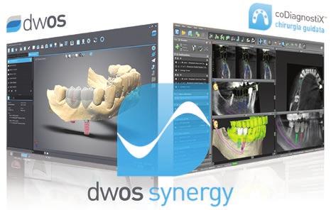 DWOS SYNERGY DWOS SYNERGY: INTEGRAZIONE DELLA PIANIFICAZIONE E DELLA MODELLAZIONE PROTESICA NEI CASI IMPLANTARI Il flusso di lavoro DWOS Synergy è la soluzione completa e integrata della Dental Wings