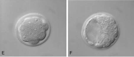 blastomeri; C, stadio a 4 blastomeri; pellucida