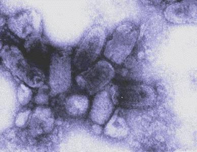 Simmetria elicoidale I virus animali a simmetria elicoidale sono tutti provvisti di envelope