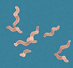 Salmonella 3. Campylobacter 4.