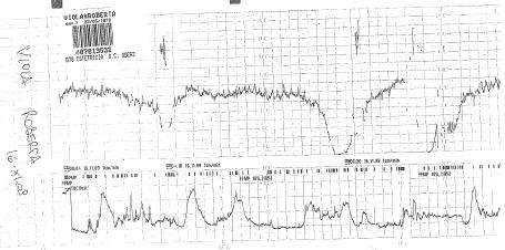 frequenza cardiaca.