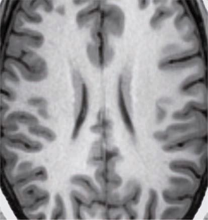 Cella media Fig. 2.