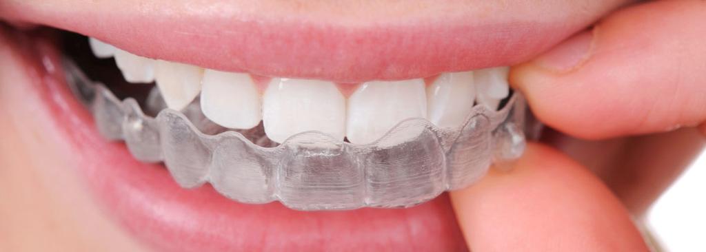 utilizzato dal dentista e dall odontotecnico per valutare e correggere la situazione orale dei pazienti) in maniera del tutto individuale.