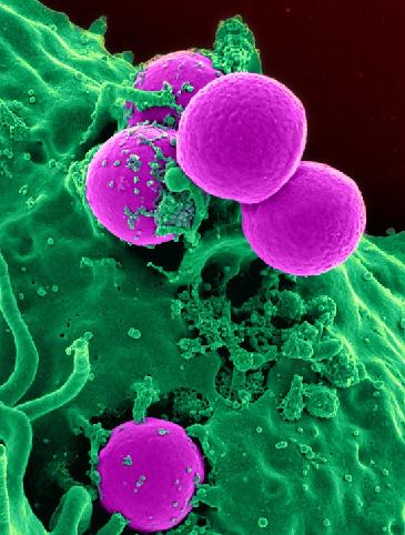 separazione dello spazio cellulare interno in tanti comparti distinti. (Figura 1) Figura 1 - Parameci: organismi unicellulari eucarioti, regno Protisti.