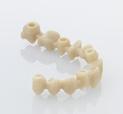 max ZirCAD Abutment ibrido / fino a 4elem. 1giorno, MO / LT ponte abutment ibrido Restauro sinterizzato, senza base in titanio da 5elem.