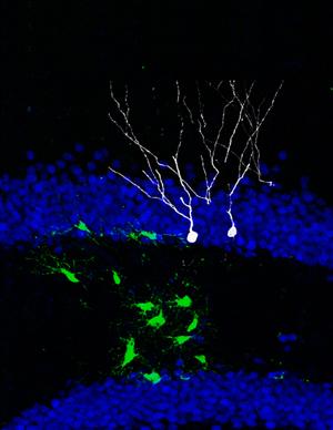 Ippocampo: connesso con la iniziale formazione della memoria La produzione di nuovi neuroni da parte delle cellule staminali nell ippocampo adulto appare