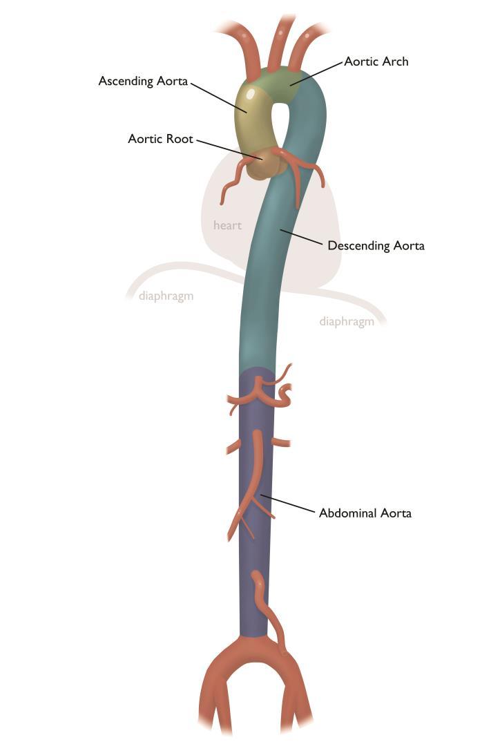 L aorta Principale arteria del corpo umano lunga 30-40cm con diametro variabile tra i 2.5cm e i 3.