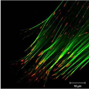 /5/54/Focaladhesiondetail.