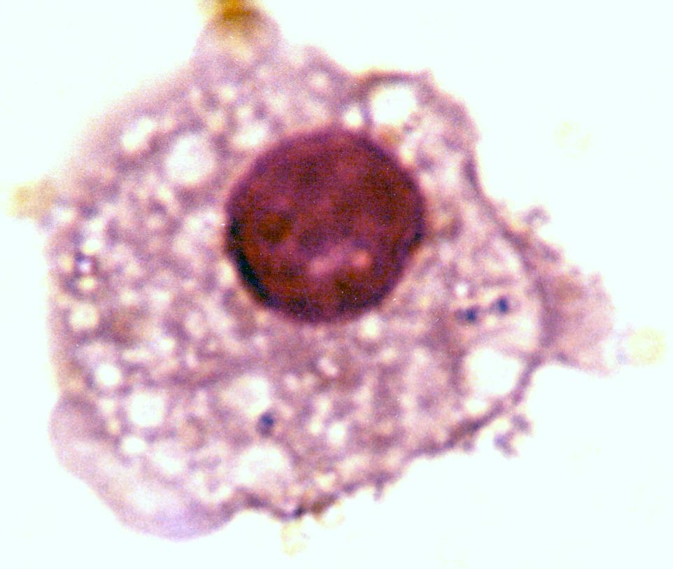 Le cellule della 2a linea di difesa Macrofagi Derivanti dai monociti Largamente distribuiti nei tessuti Cellule circolanti (sentinella)