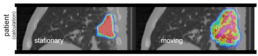 Futuro della scansione attiva Sviluppi futuri: Ridurre la sensibilita al movimento degli organi migliorando il BDS e l acceleratore per eseguire: Faster scanning Repainting