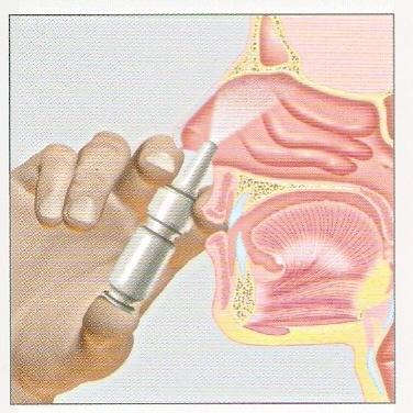 Instanyl - Spray nasale base