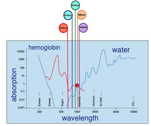 5 LUNGHEZZE D ONDA DISPONIBILI 980nm Assorbimento acqua: ~40% Assorbimento emoglobina:~10% E la lunghezza d onda con il più alto assorbimento da parte dell acqua e quindi a pari potenza è la