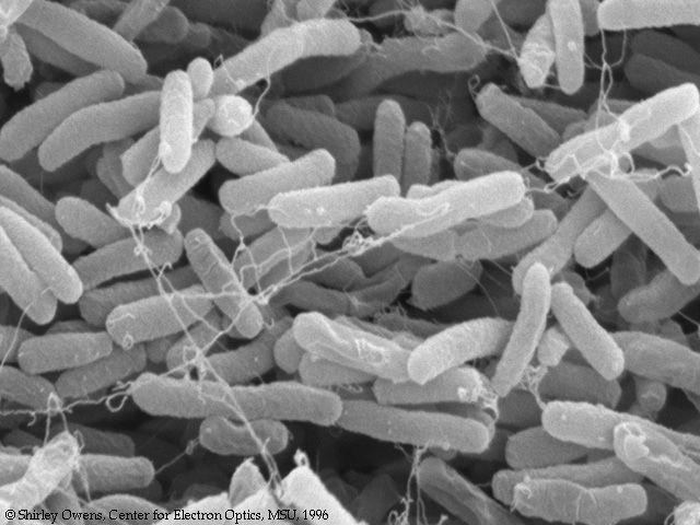 . Escherichia coli Bacilli Gram- (1-2 x 3-30 µm), anaerobi