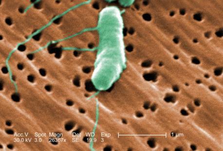 V. parahaemolyticus gastroenterite V. vulnificus contaminazione di acque o alimenti e di ferite aperte. Alcuni ceppi hanno capacità invasive e distruttive dei tessuti molli.