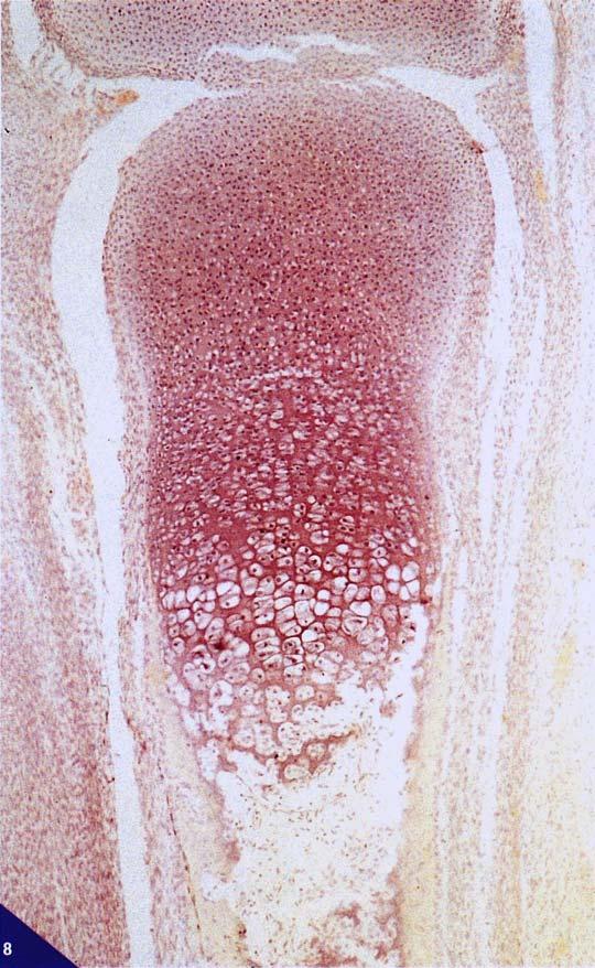 Le cellule cartilaginee ipertrofiche vanno quindi incontro a modificazioni regressive, che consistono nell'ingrossamento del nucleo e nella perdita della cromatina, muoiono e degenerano mentre la