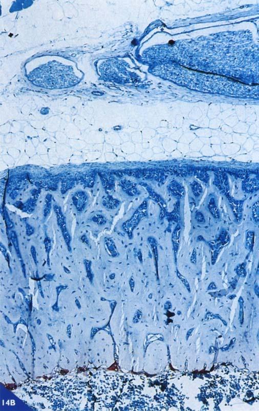 L accrescimento diametrale, invece, è dovuto alla deposizione di nuovo osso sulla superficie periostale e alla contemporanea erosione sul lato endostale.