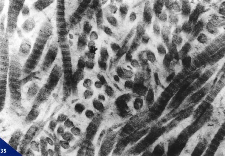 Il collagene, uno dei principali costituenti extracellulari della maggior parte dei tessuti connettivi, è una proteina fibrosa dalla caratteristica bandeggiatura in microscopia elettronica, che