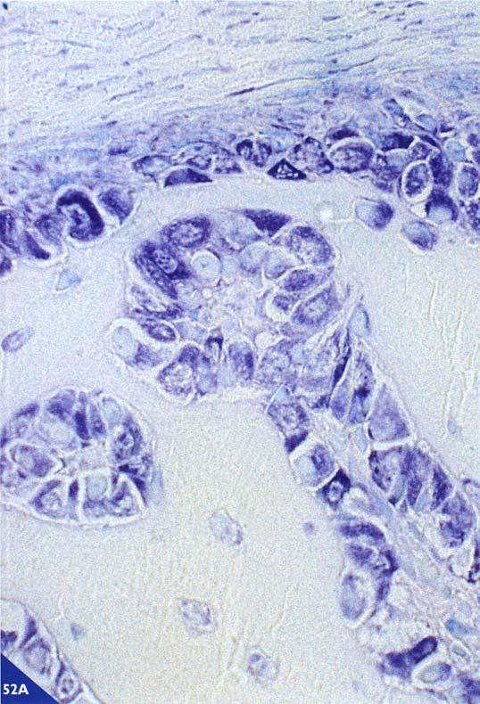 52. Immagini al microscopio ottico di sezioni colorate (a sinistra) istologicamente con blu