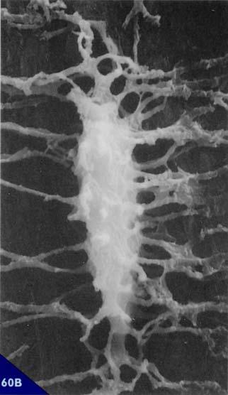 Una volta completata la deposizione, i corpi cellulari di tali elementi rimangono racchiusi in piccole cavità che ne riproducono la forma, definite