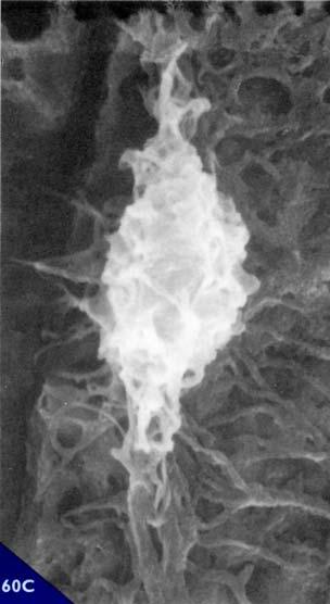et al 1990). 59. Lacune osteocitarie al microscopio ottico. I vuoti (in nero) evidenziano sia le lacune sia la rete canalicolare pervia.