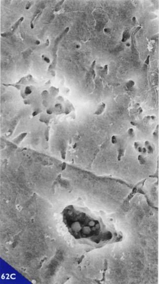 1985). 61. Osteocita. La cellula isolata (a), nella lacuna osteocitana (b), e la sola lacuna (c). 62. Lacune osteocitarie al SEM.